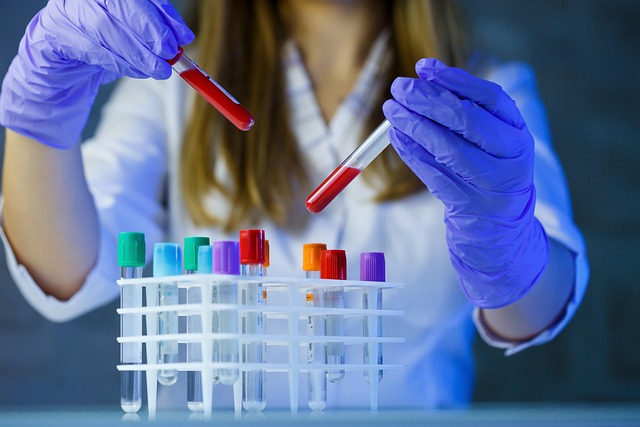 Sample Preparation Market 